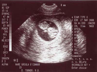 Jr1-400.jpg (28056 bytes)