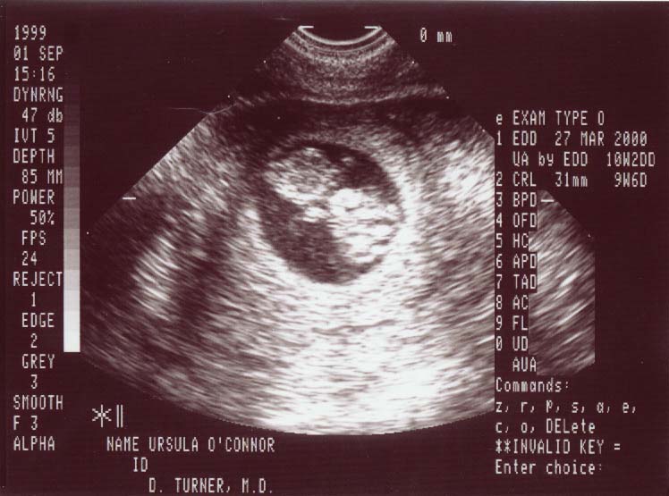 Jr1.jpg (66915 bytes)