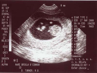 Jr2-400.jpg (28883 bytes)