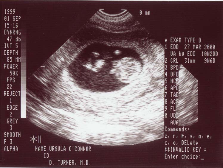 Jr2.jpg (69499 bytes)