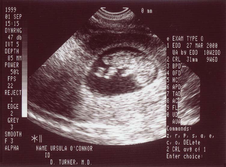 Jr3.jpg (68009 bytes)